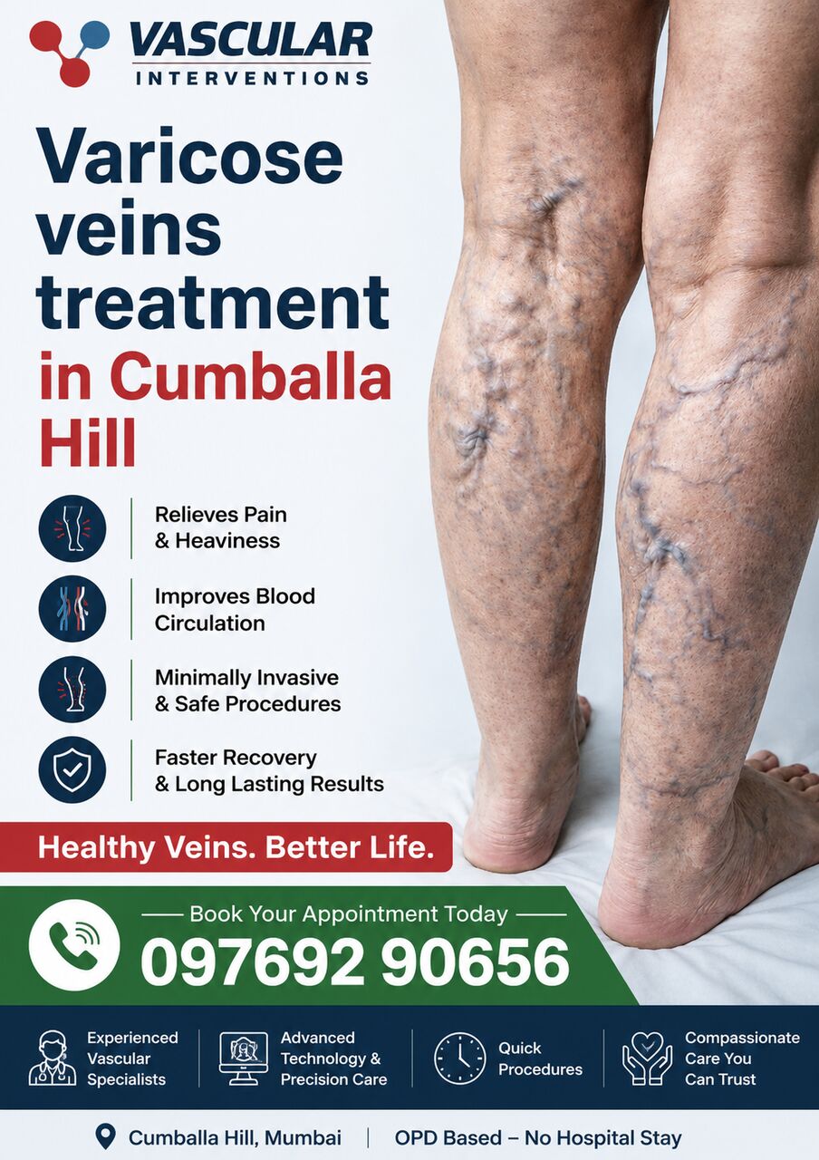 Mumbai, Health, Expert Solutions For Healthy Veins