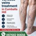 Expert Solutions For Healthy Veins