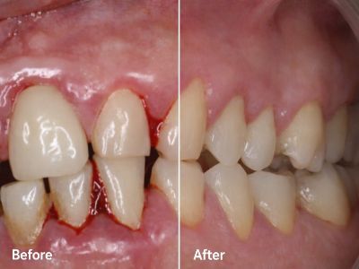Kolkata, General, Best Dental Clinic In Newtown &ndash; Trusted Care At AB Dentologic