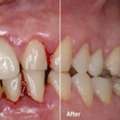 Best Dental Clinic In Newtown &ndash; Trusted Care At AB Dentologic