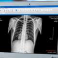Reliable Mobile Diagnostic Support With Mobile Imaging Services