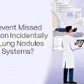 Advanced Incidental Nodule Lung Tracking