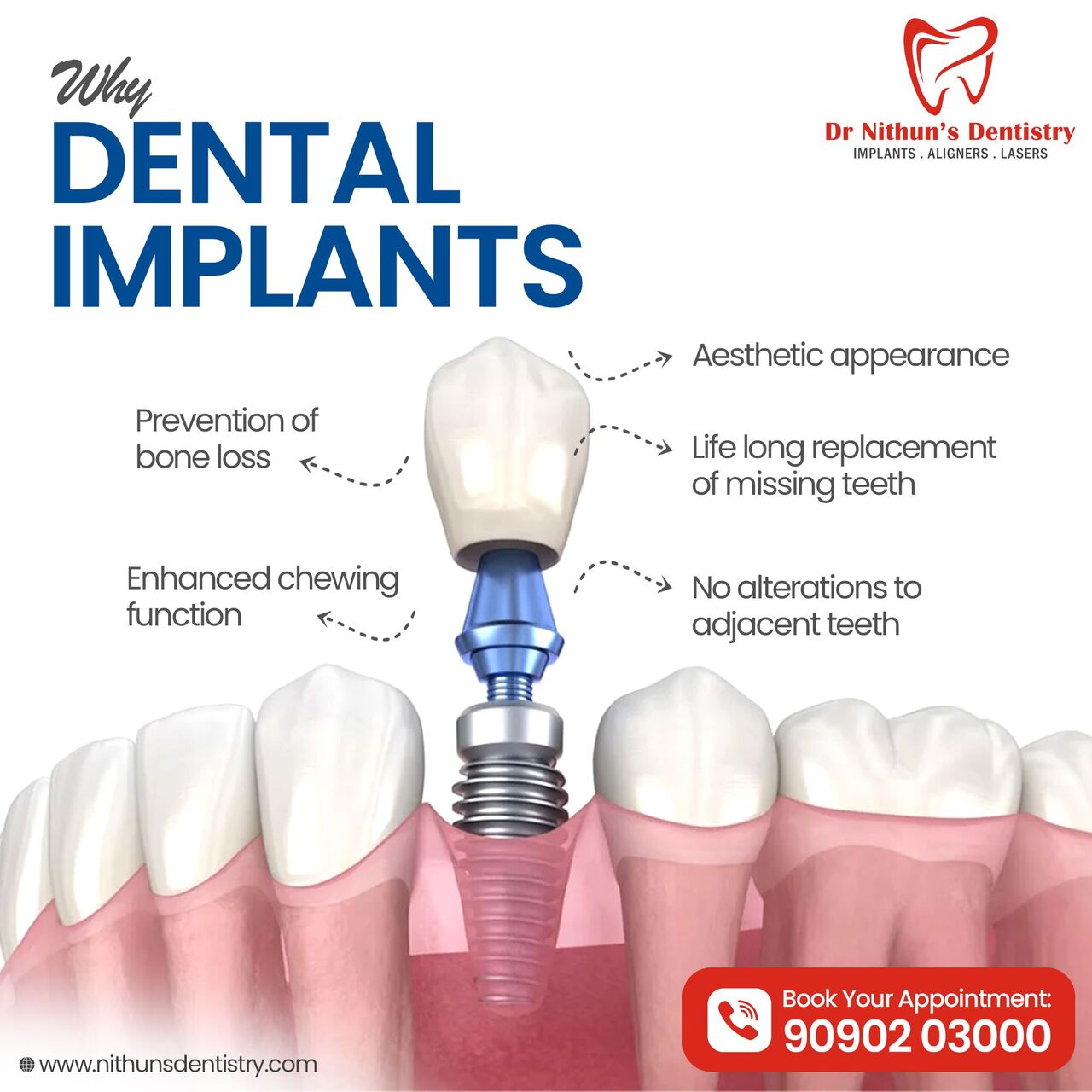 Hyderabad, Dental, Best Dental Implant Center In Kompally