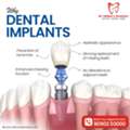 Best Dental Implant Center In Kompally