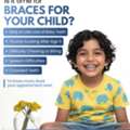 Braces Treatment In Indiranagar