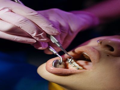 Kolkata, General, AB Dentologic &ndash; Your Trusted Choice For The Best Dental Clinic In Newtown