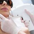 Permanent Hair Removal Mississauga For Silky Smooth Skin