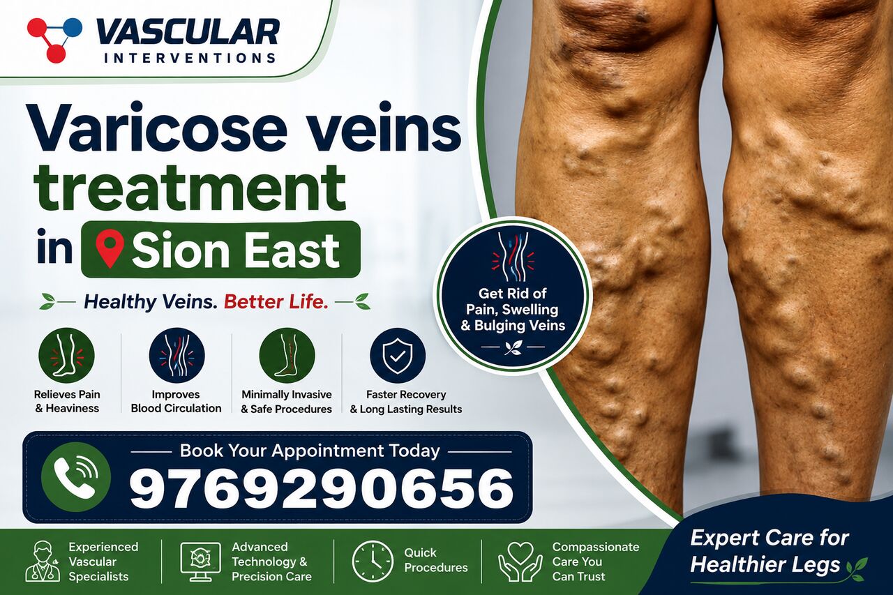 Mumbai, Health, Comprehensive Care For Varicose Veins