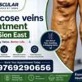 Comprehensive Care For Varicose Veins