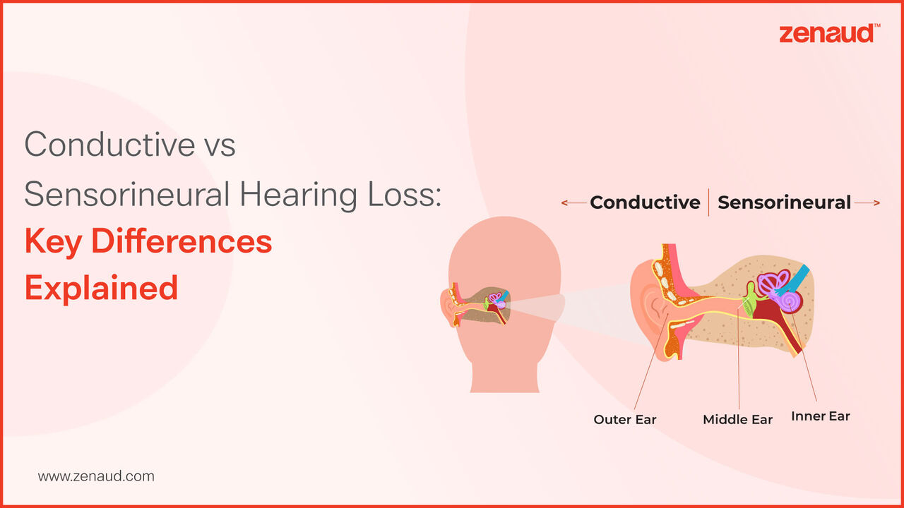 Hyderabad, Health & Beauty Items, INR 16000,  Conductive Vs Sensorineural Hearing Loss | Zenaud