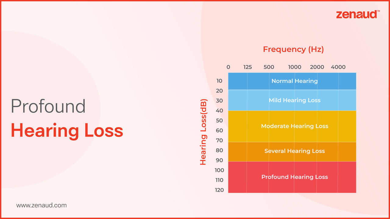 Hyderabad, Health & Beauty Items, INR 16000,  Profound Hearing Loss - Zenaud