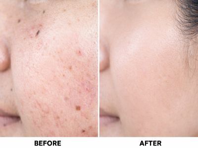 Kolkata, General, Advanced Aesthetic Treatments At The Aesthetic House