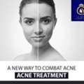 DNA Royal | Effective & Affordable Best Acne Treatment In Thane.