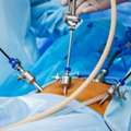Laparoscopy For Infertility Cost In Delhi - Dr Rhythm Gupta