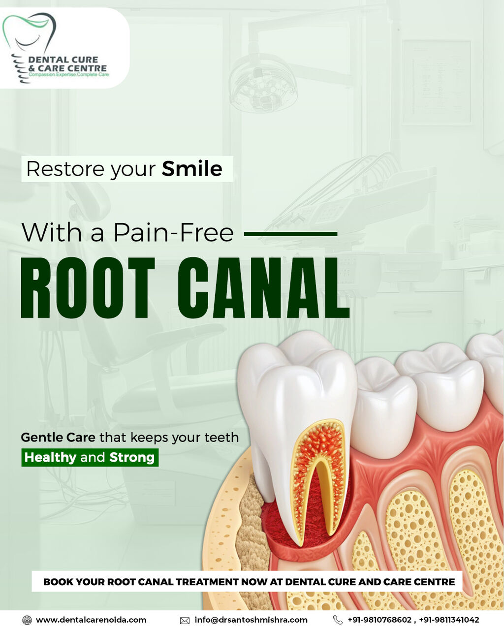 Noida, Dental, Emergency Root Canal Treatment In Noida