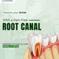 Emergency Root Canal Treatment In Noida