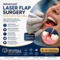 Say Goodbye To Bleeding Gums! Painless Laser Flap Surgery In AS Rao Nagar 🦷✨
