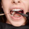 Best Damaged Tooth Treatment Service In Mickleham - Quality Dental Care Mickleham