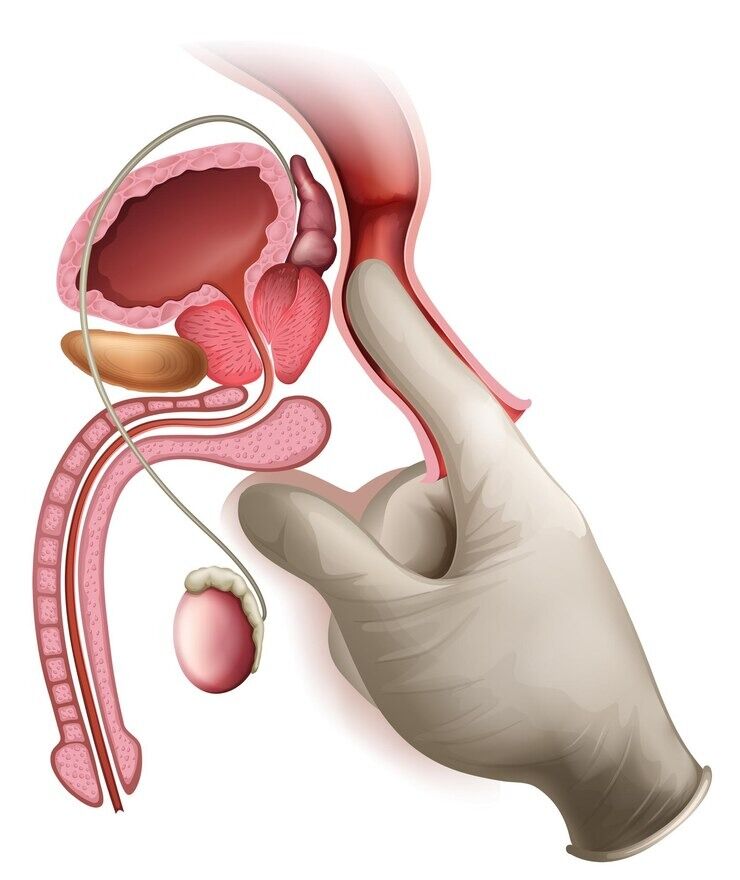 Melbourne, Medical, Vasectomy Services in Melbourne with Personalised Surgical Care