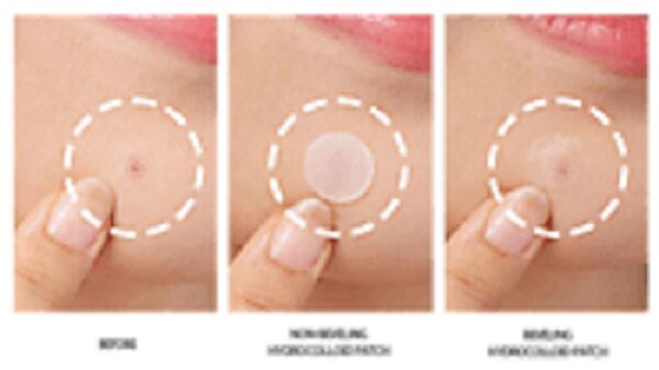 New York, Health, Pimple Patch Manufacturer