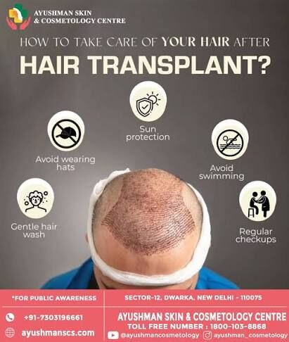 New Delhi, Health, Advanced Hair Plantation Delhi | Ayushman Hair Care