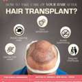 Advanced Hair Plantation Delhi | Ayushman Hair Care
