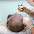 Precision Grafting, Permanent Results!