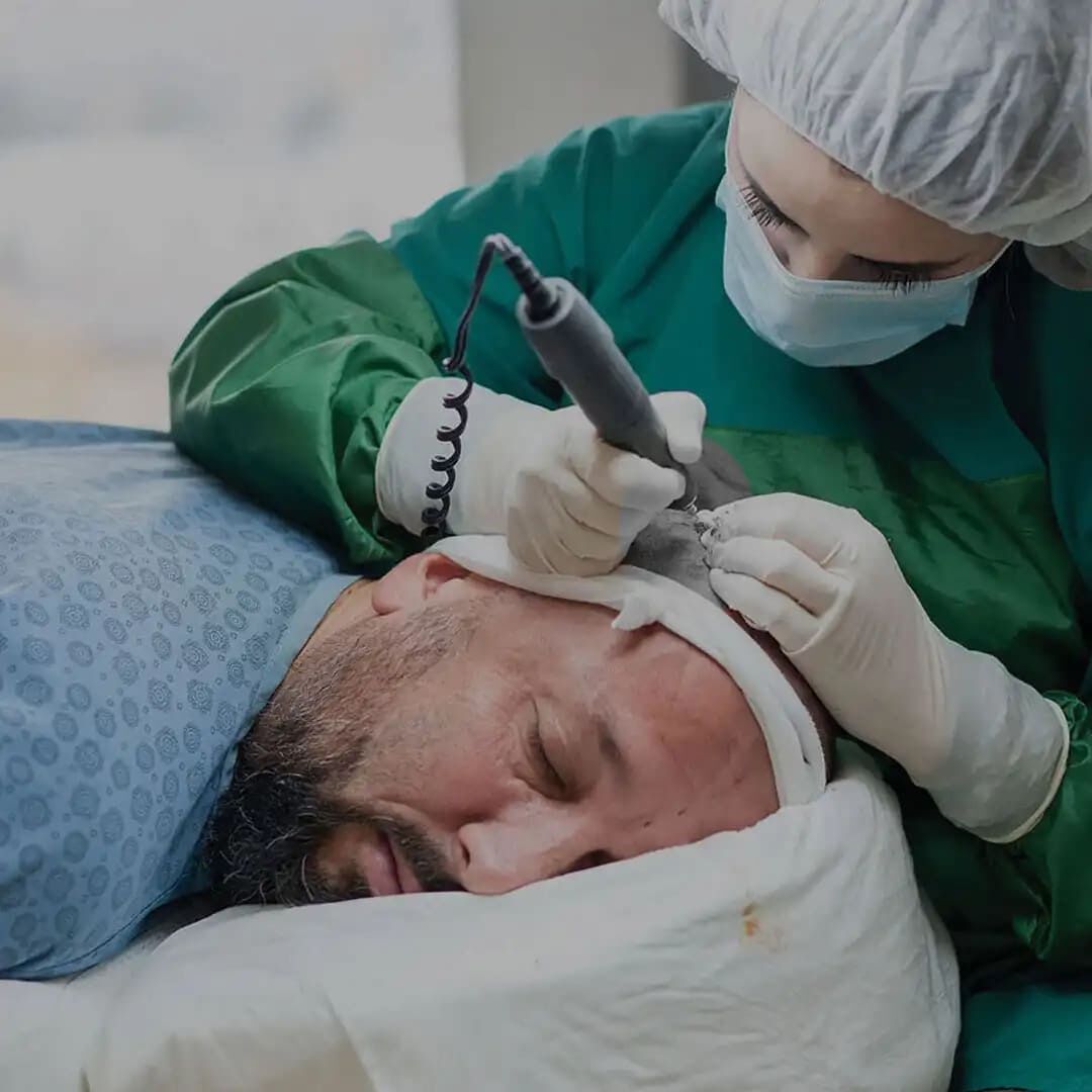 New Delhi, Health, Precision Grafting, Permanent Results!
