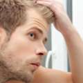 Hair Loss Solutions For Men London | Skulltec