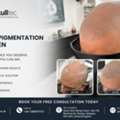 Micropigmentation London | Scalp Pigmentation Specialist | Skulltec
