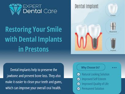 Sydney, Dental, Restoring Your Smile With Dental Implants In Prestons