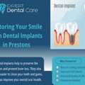 Restoring Your Smile With Dental Implants In Prestons
