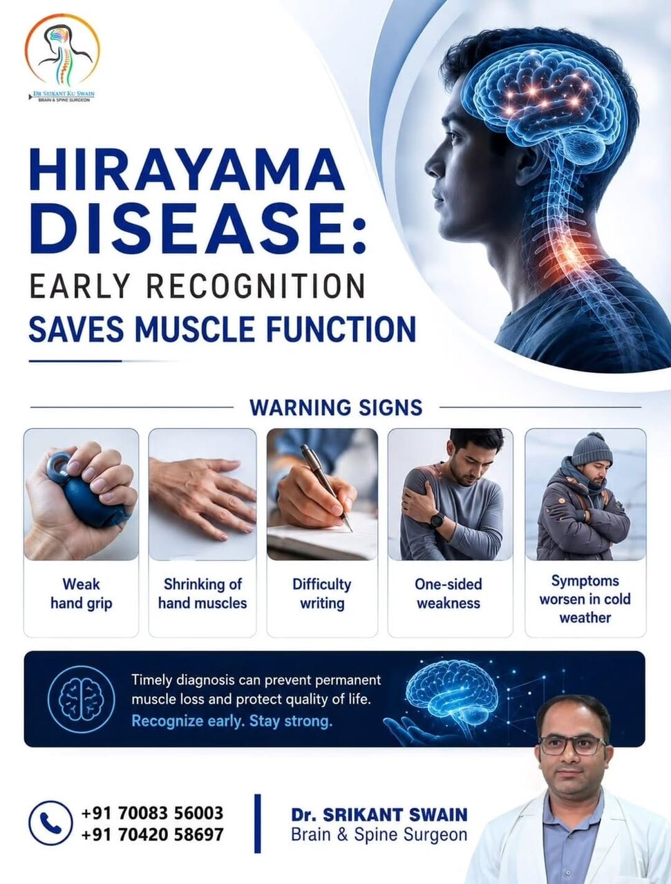 Bhubaneswar, Health, Hirayama Disease | Best Neurosurgeon In Bhubaneswar | Dr. Srikant Swain