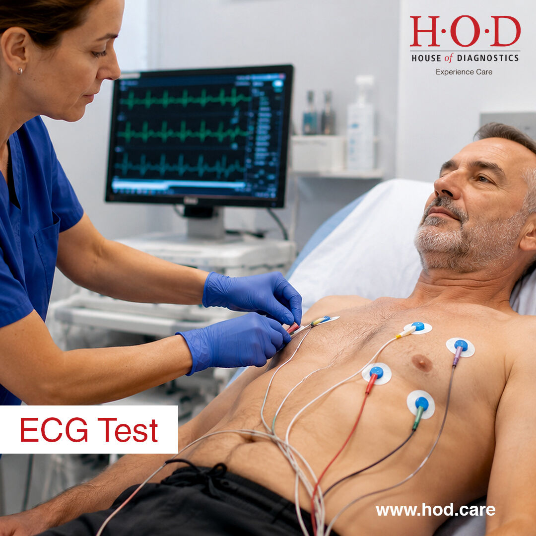 New Delhi, Health & Beauty Items, INR 249,  Book ECG Test From Best Diagnostics Centre At House Of Diagnostics