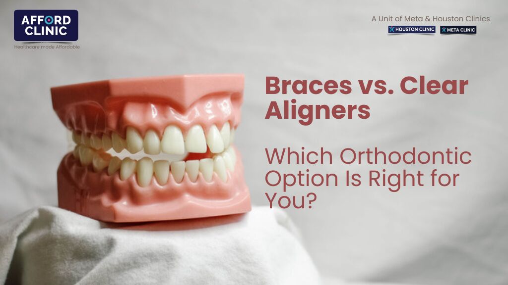 Al Nahda, Dental, Braces Vs. Clear Aligners: Which Orthodontic Option Is Right For You?