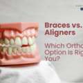 Braces Vs. Clear Aligners: Which Orthodontic Option Is Right For You?