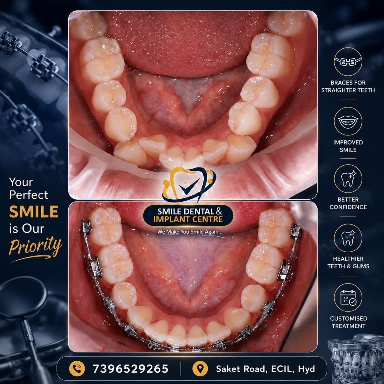 Hyderabad, Dental, Orthodontic & Braces Care Specialist &ndash; Smile Dental & Implant Centre, ECIL