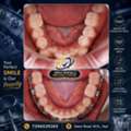 Orthodontic & Braces Care Specialist &ndash; Smile Dental & Implant Centre, ECIL