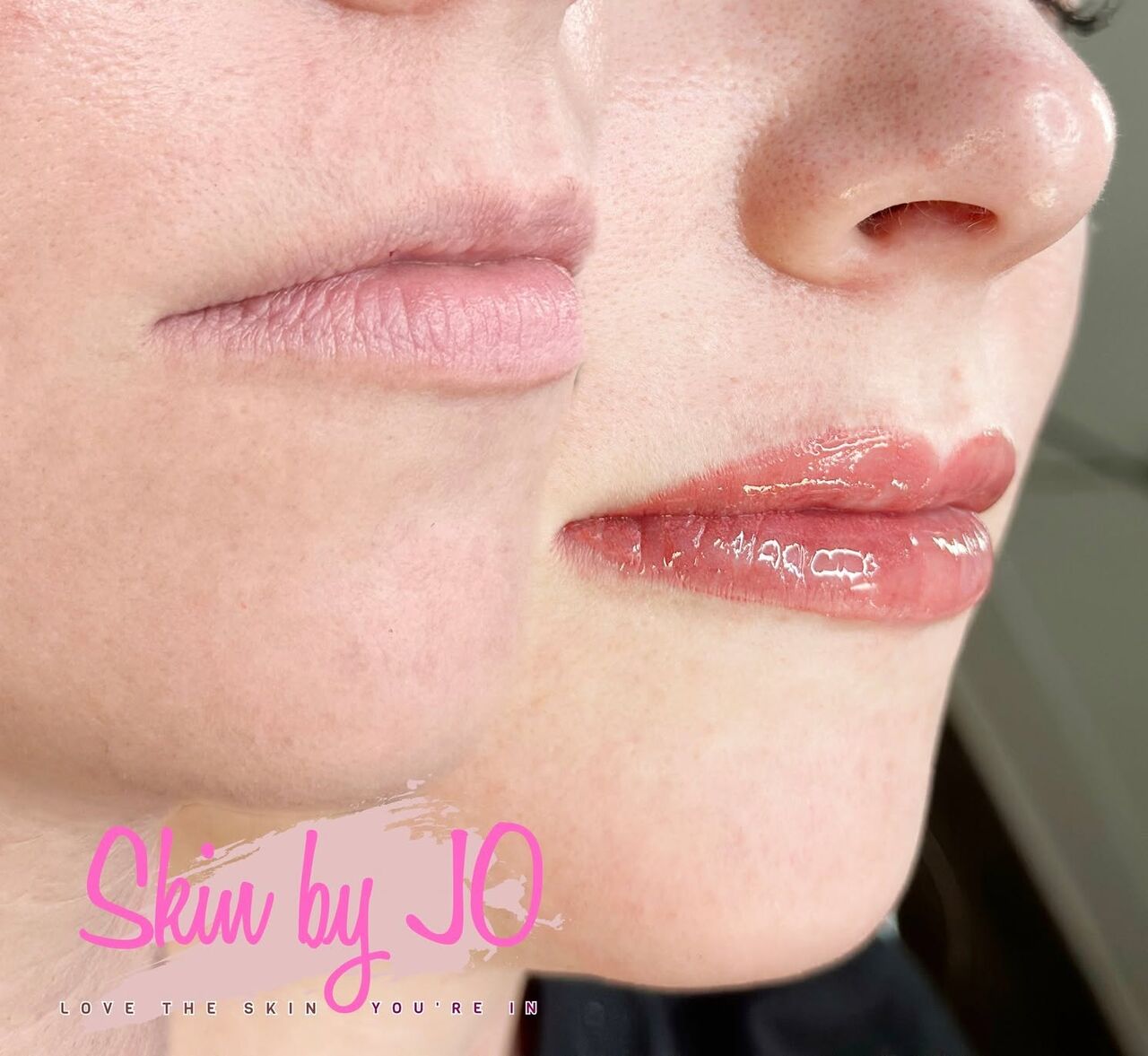 New York, Beautician, Skin By Jo | Skin Care Clinic | Waxing Service Rockledge, FL