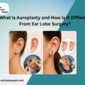 What Is Auroplasty And How Is It Different From Ear Lobe Surgery