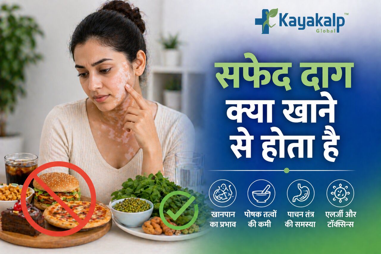 New Delhi, Health, सफेद दाग क्या खाने से होता है? कारण और इलाज | Kayakalp Gl