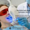 The ZOOM Teeth Whitening Services In Scottsdale | Kevin Harris Dentist