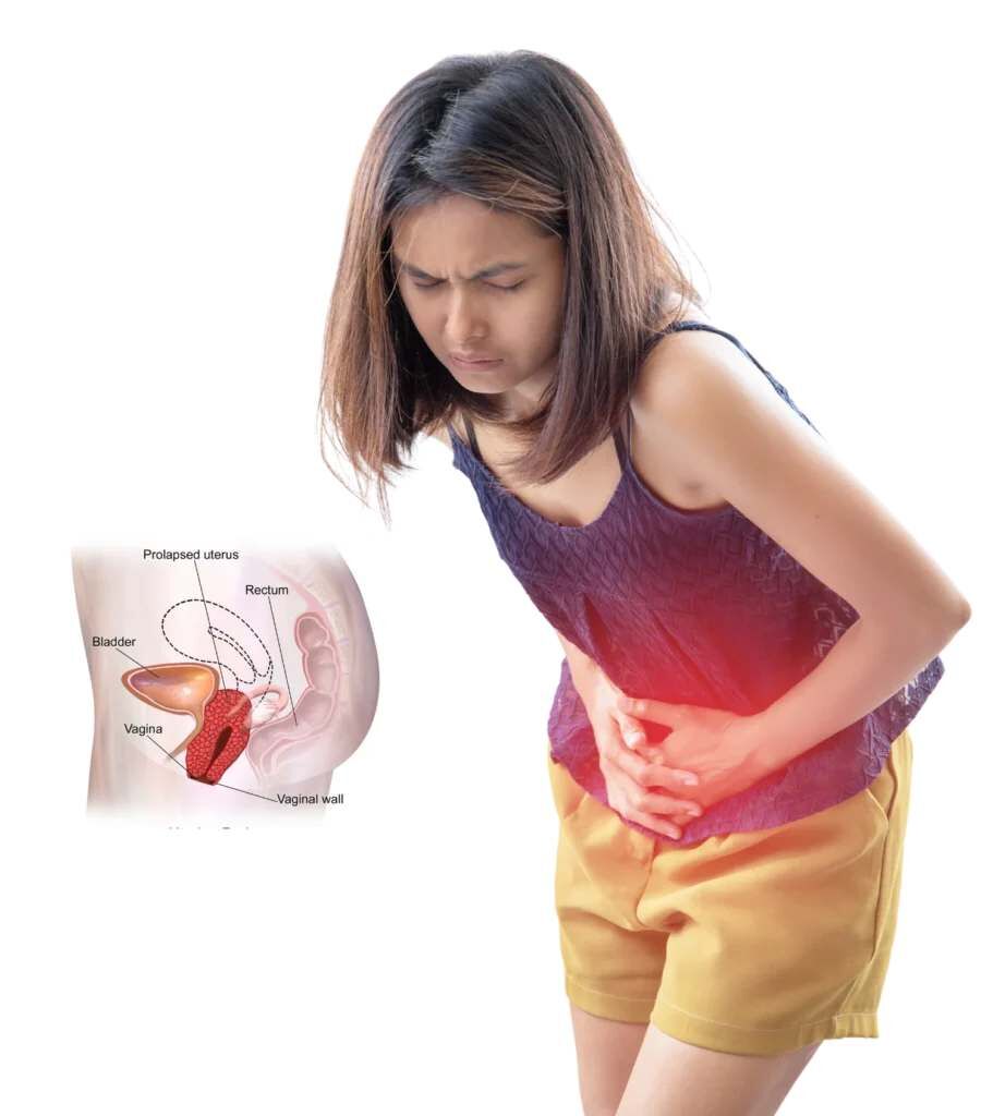 Mumbai, Health, Ayurvedic Treatment For Uterus Prolapse Without Surgery