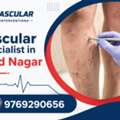 Professional Vein Treatment For Better Living