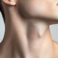 Neck Lift Surgery In Los Angeles