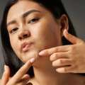 Carbon Peel Laser Treatment In Nagpur For Clear & Radiant Skin