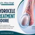 Expert Hydrocele Management With Advanced Urology Support
