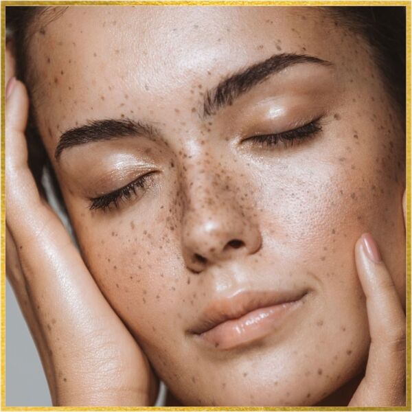Los Angeles, Health, Nose Job In Los Angeles