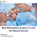 Best Rhinoplasty Surgery In India For Natural Results
