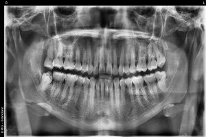 Mexico City, Dental, Get That Ideal Smile Makeover From The Best Tijuana Dentist